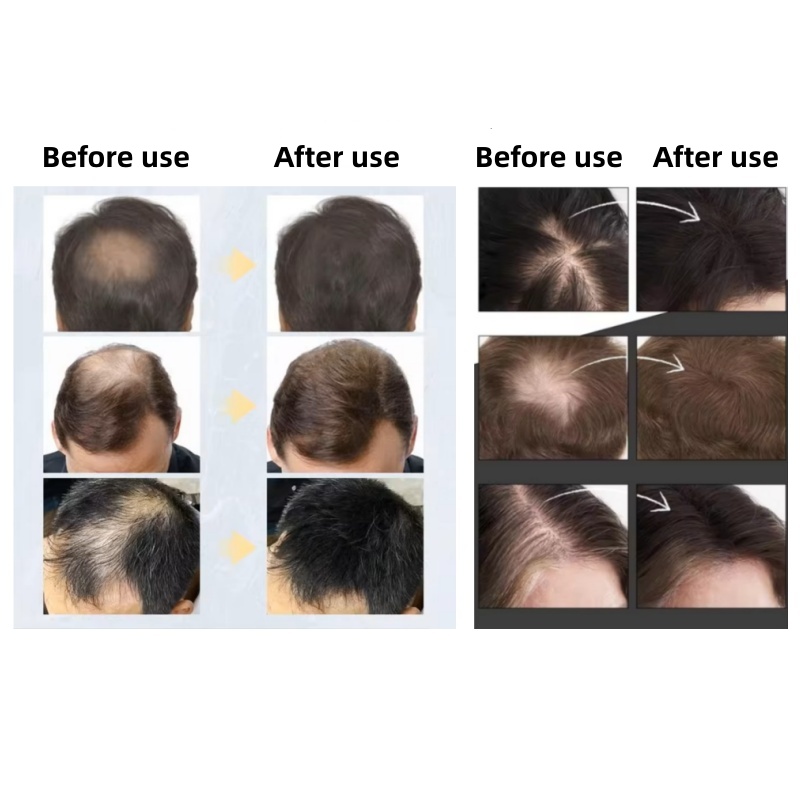 20 قطعة من ألياف الشعر الكيرات - مراجعة Hair Care Near Me وسعره