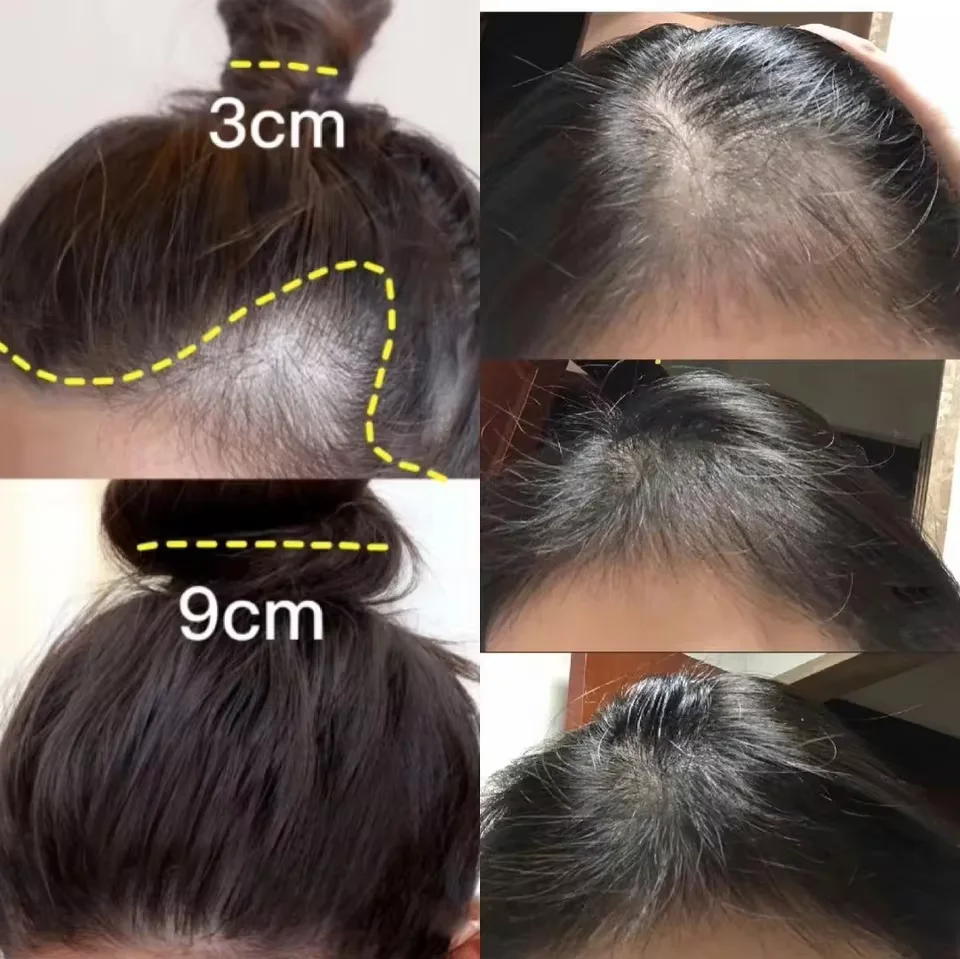 كريم نمو الشعر بالزنجبيل السري - مراجعة Hair Care Near Me وسعره