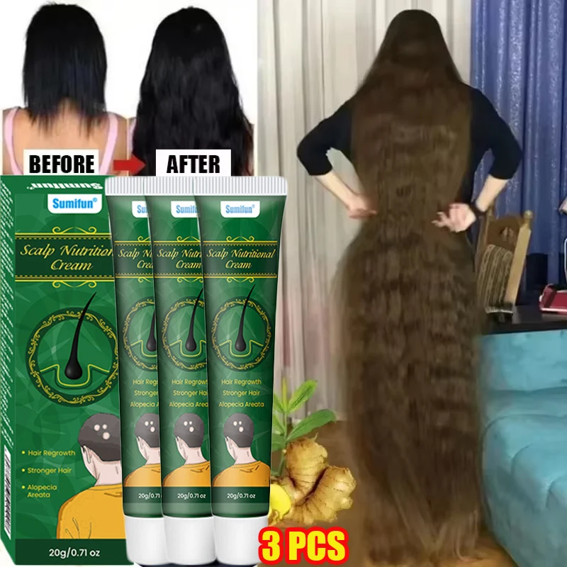 كريم نمو الشعر بالزنجبيل السري - مراجعة Hair Care Near Me وسعره