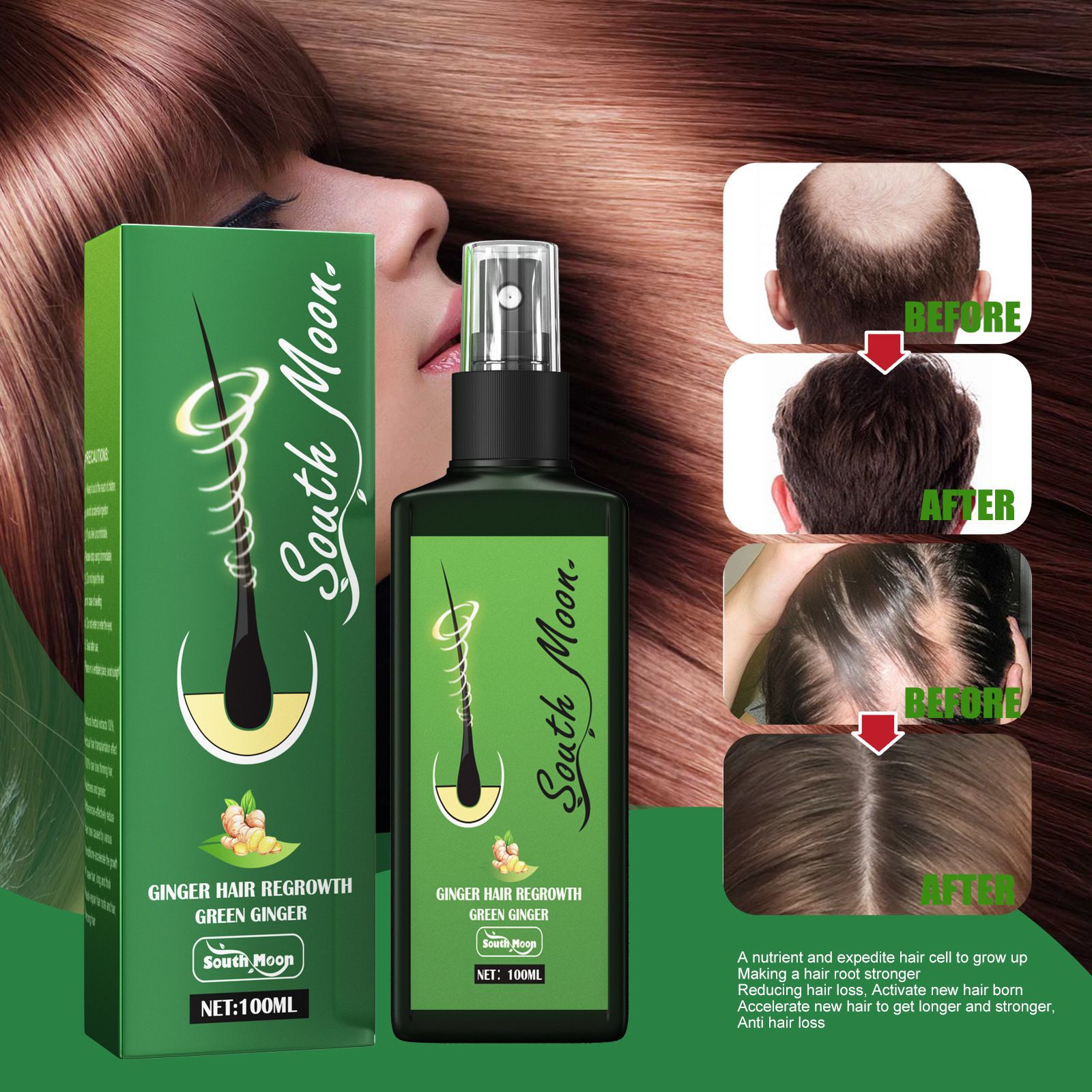 بخاخ نمو الشعر بالزنجبيل من سا - مراجعة Hair Care Basic وسعره
