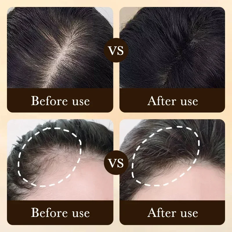 زيت البيوتين لنمو الشعر السريع - مراجعة Hair Care Near Me وسعره