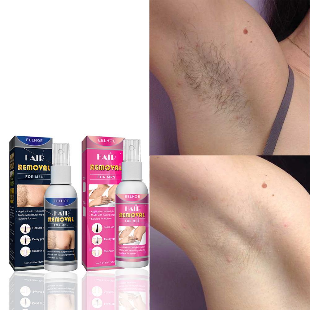 1/2 قطعة مزيل الشعر الدائم غير - مراجعة Hair Care Women وسعره