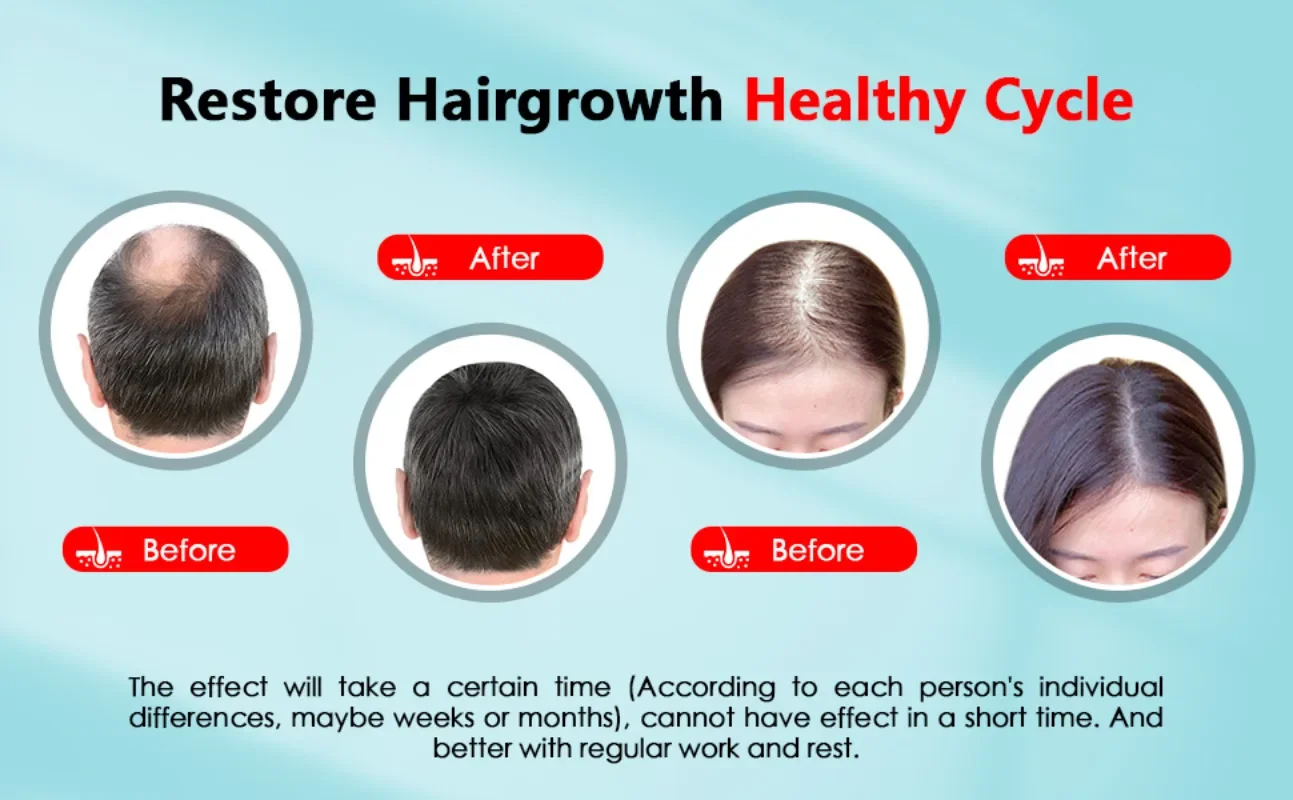 غطاء نمو الشعر قابل لإعادة الش - مراجعة Hair Care Basic وسعره