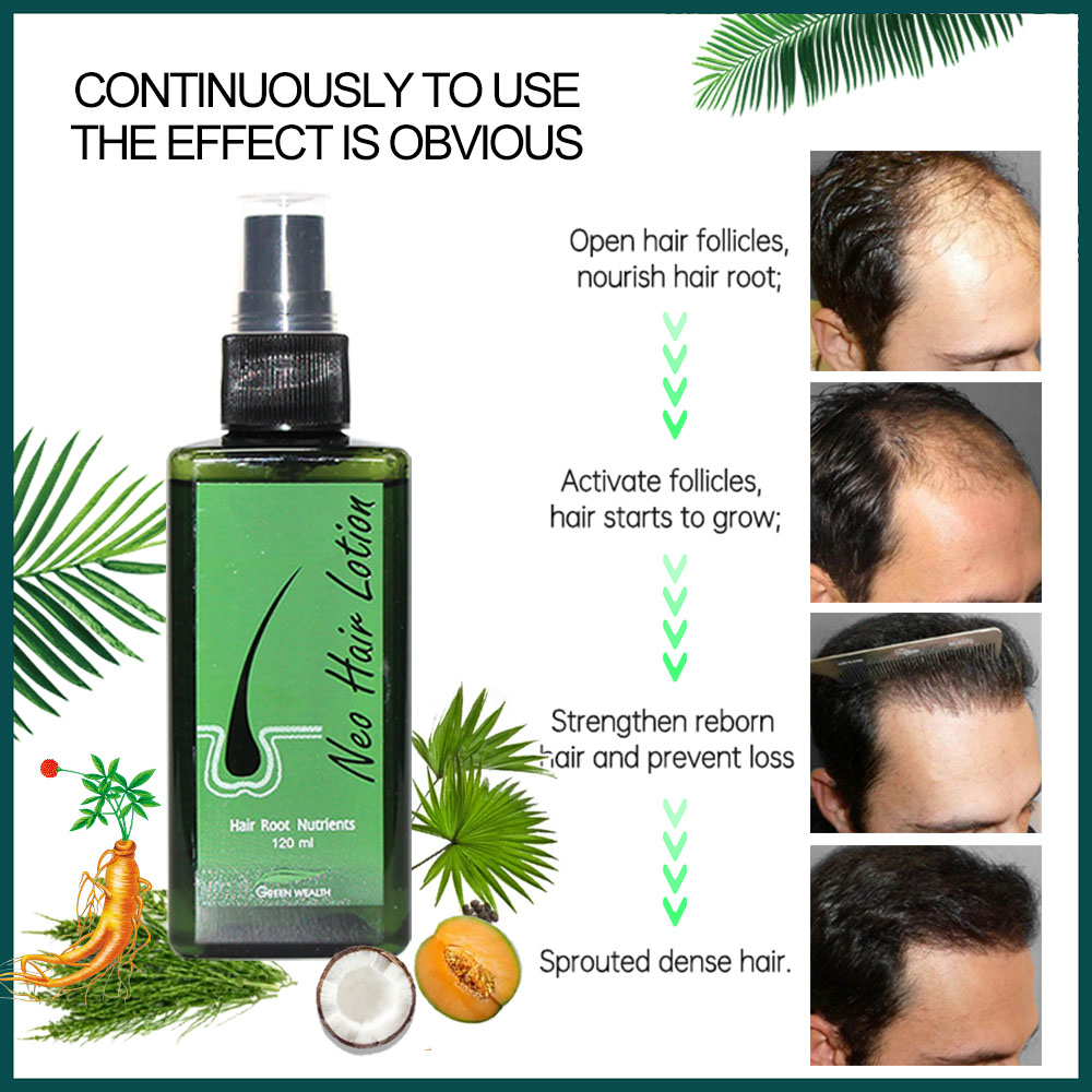 4 قطع لوشن نيو للشعر 120 مل، م - مراجعة Hair Care Basic وسعره