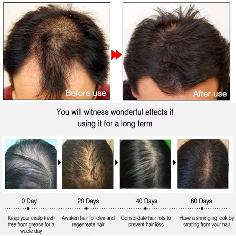 بخاخ الزنجبيل السريع لنمو الشع - مراجعة Hair Care Vegan وسعره